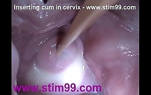 Intercalate semen cum up cervix alongside dilatation pussy send back